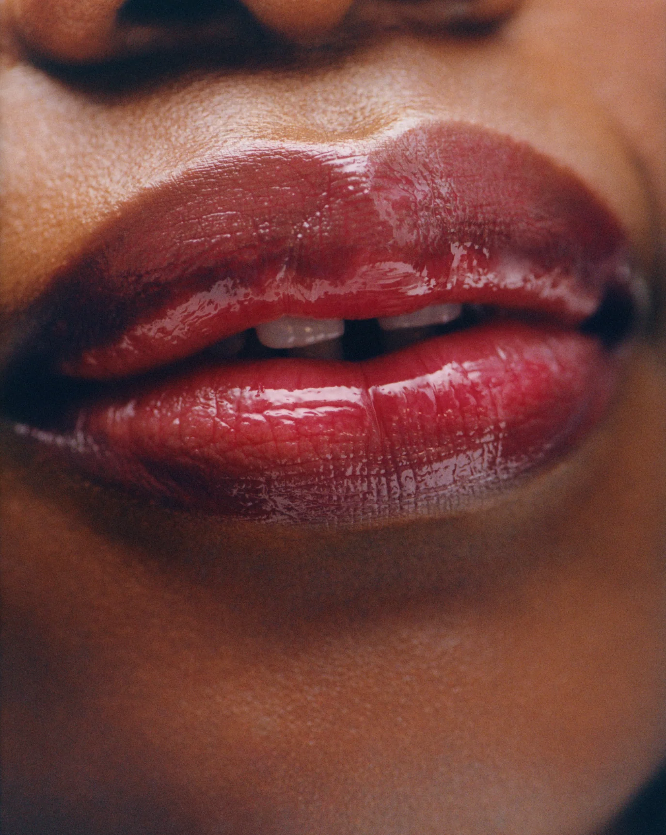 Ultralip - Image 86