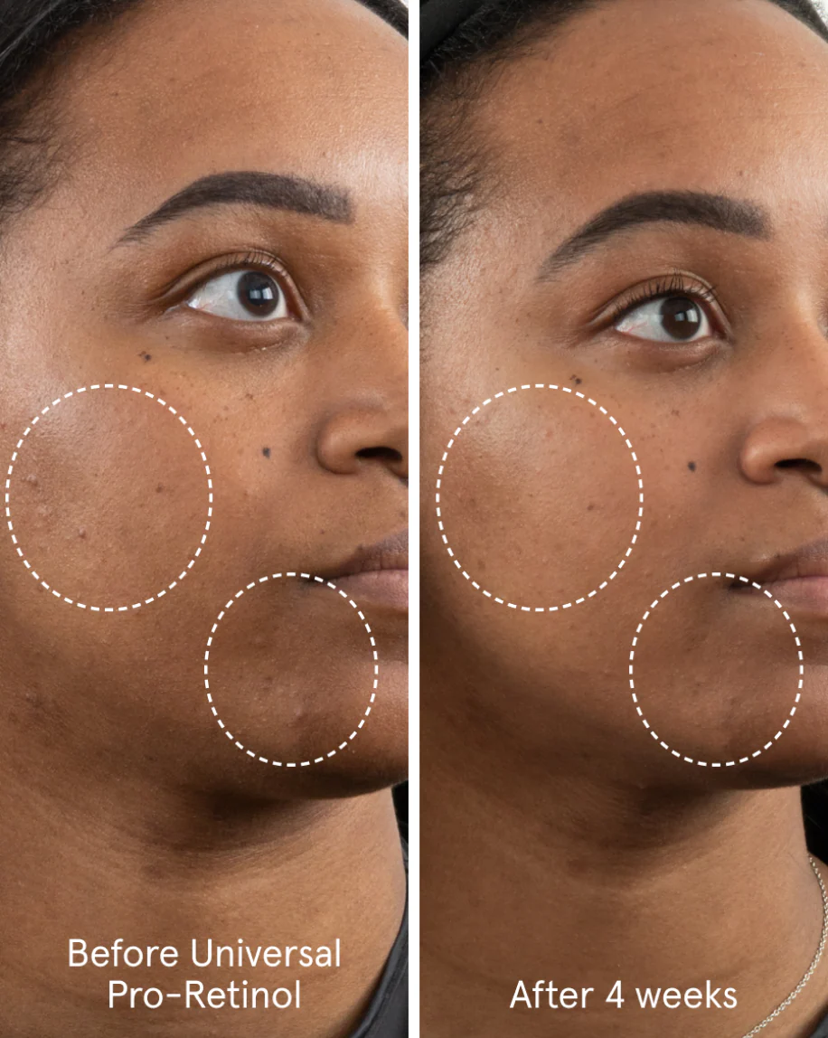 Universal Pro-Retinol - Image 3