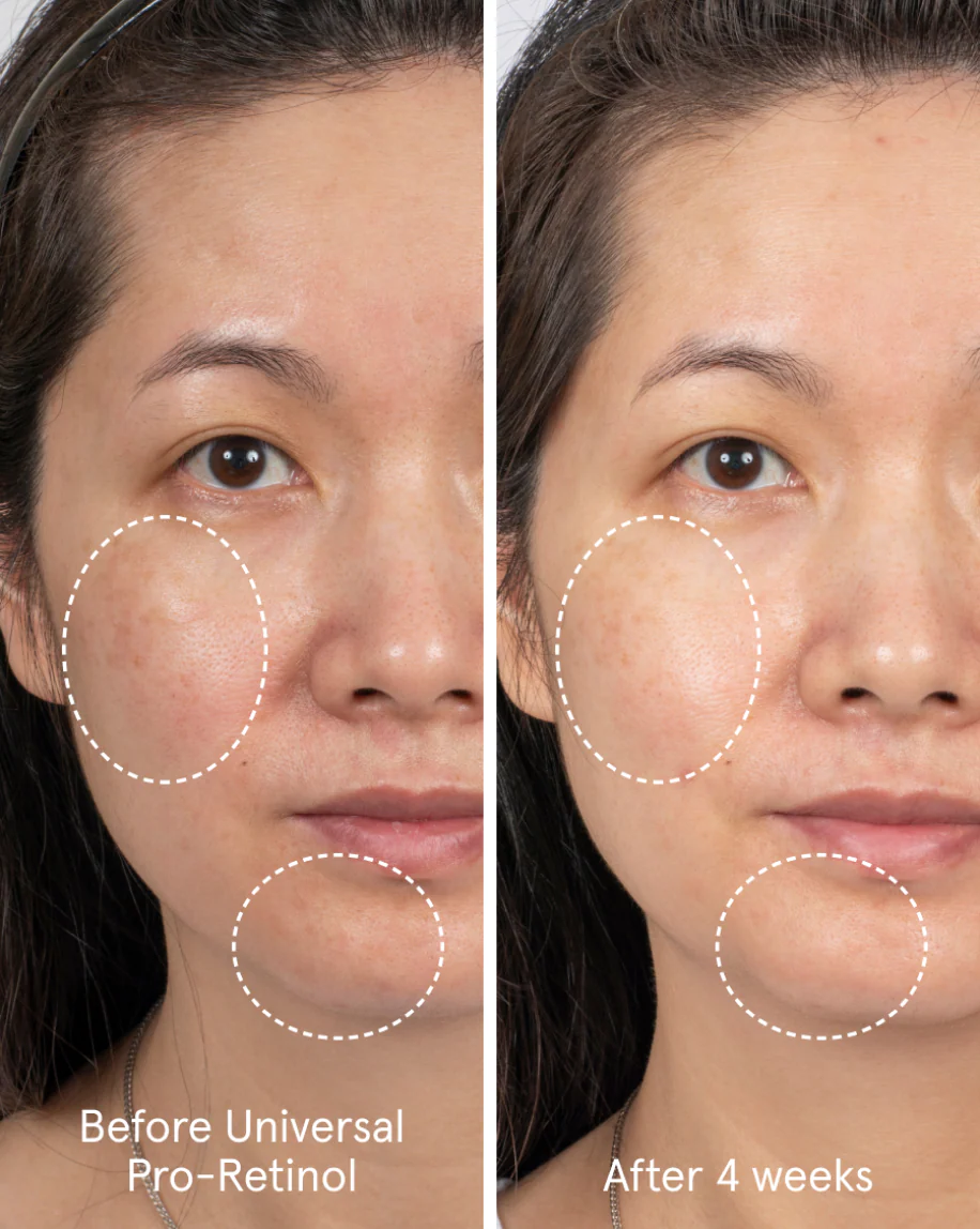 Universal Pro-Retinol - Image 4