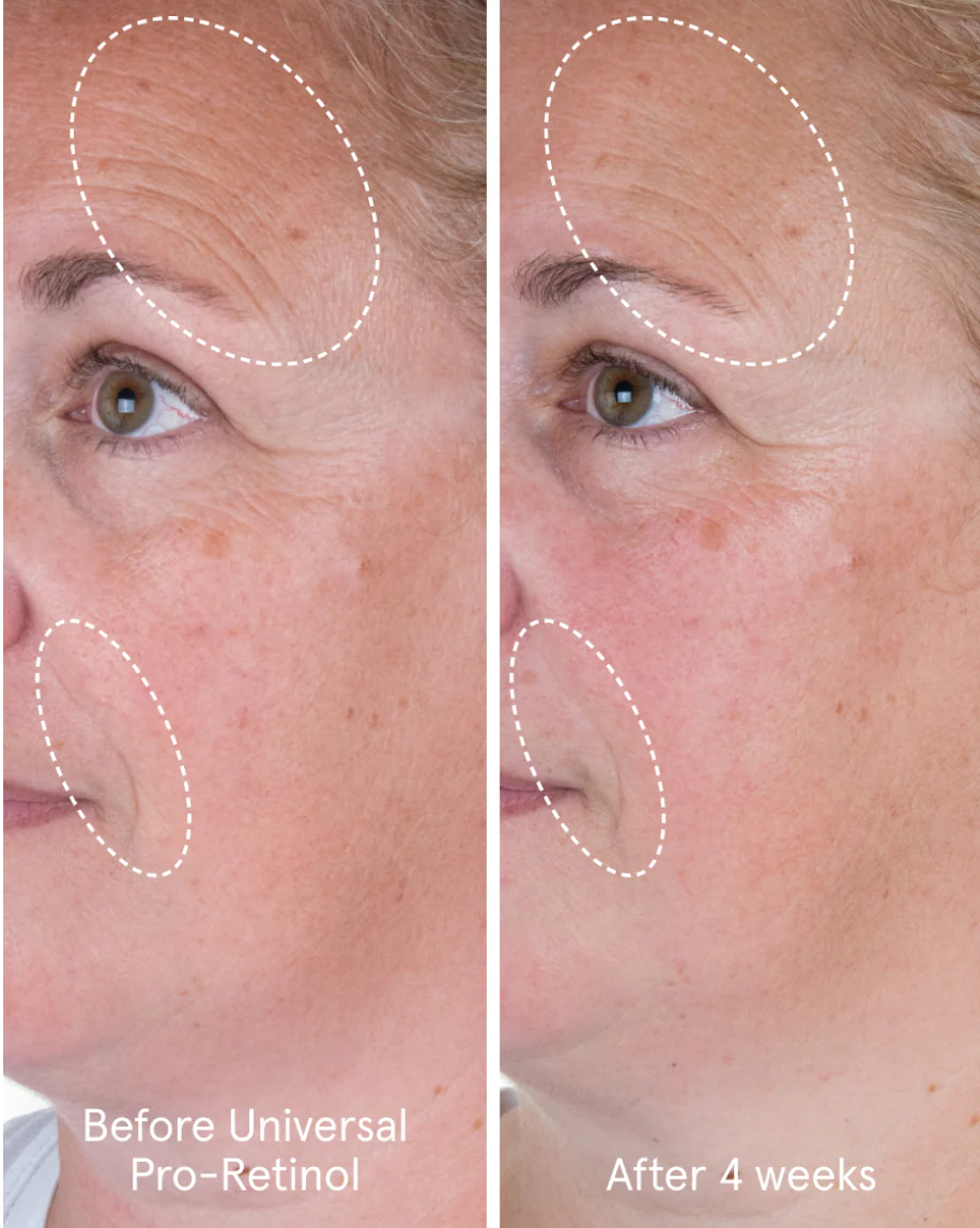 Universal Pro-Retinol - Image 6